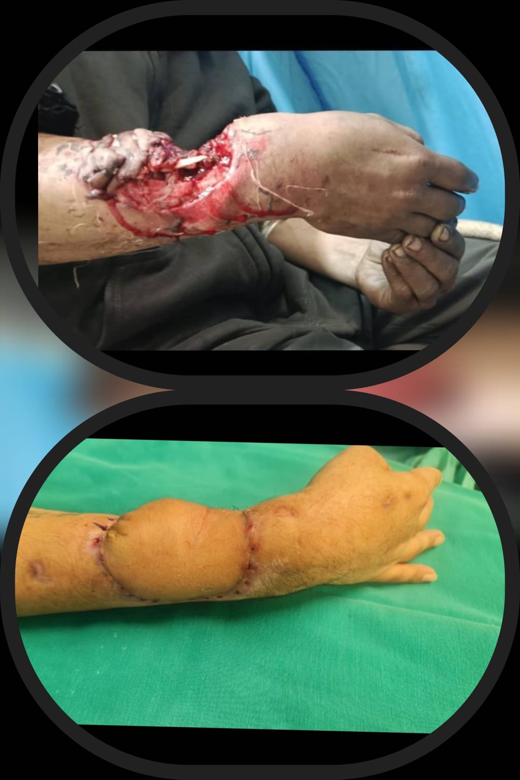 Before & After 35